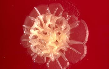 Pseudomonas stutzeri (Stutzerimonas stutzeri) Blood Agar 48h culture incubated with O2