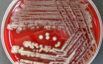 Pseudomonas stutzeri (Stutzerimonas stutzeri) Blood Agar 48h culture incubated with O2