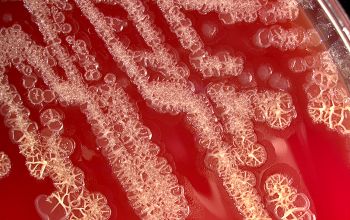Pseudomonas stutzeri (Stutzerimonas stutzeri) Blood Agar 48h culture incubated with O2