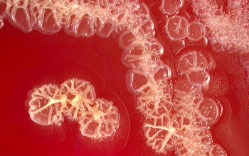 Pseudomonas stutzeri (Stutzerimonas stutzeri) Blood Agar 48h culture incubated with O2