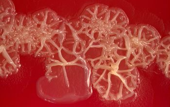 Pseudomonas stutzeri (Stutzerimonas stutzeri) Blood Agar 48h culture incubated with O2