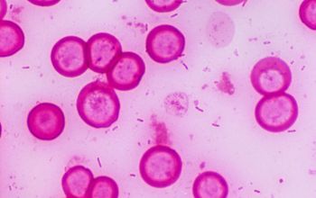 Pseudomonas stutzeri (Stutzerimonas stutzeri) Gram stain