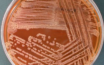 Pseudomonas stutzeri (Stutzerimonas stutzeri) Mac Conkey Agar without salt 48h culture incubated with O2