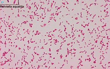 Rahnella aquatilis Gram stain