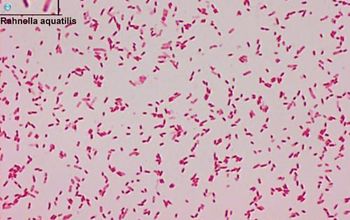 Rahnella aquatilis Gram stain