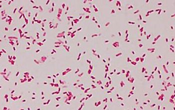 Rahnella aquatilis Gram stain