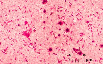 Rhizobium radiobacter (Agrobacterium radiobacter) Gram stain