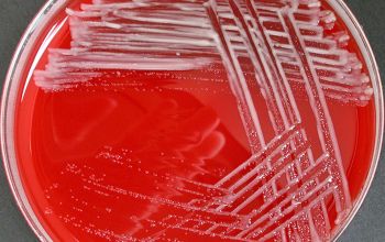 Rhizobium radiobacter (Agrobacterium radiobacter) Blood Agar 24h culture incubated with O2