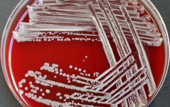 Rhizobium radiobacter (Agrobacterium radiobacter) Blood Agar 48h culture incubated with O2