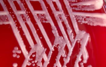 Rhizobium radiobacter (Agrobacterium radiobacter) Blood Agar 48h culture incubated with O2