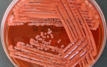 Rhizobium radiobacter (Agrobacterium radiobacter) Mac Conkey Agar without salt 48h culture incubated with O2