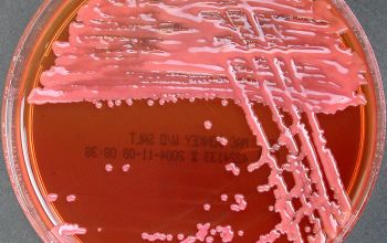 Rhizobium radiobacter (Agrobacterium radiobacter) Mac Conkey Agar without salt 48h culture incubated with O2