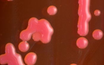 Rhizobium radiobacter (Agrobacterium radiobacter) Mac Conkey Agar without salt 48h culture incubated with O2