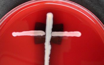 Rhodococcus equi / Prescottella equi Blood Agar 24h culture 