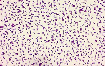 Rhodococcus equi / Prescottella equi Gram stain