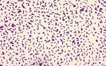 Rhodococcus equi  (Prescottella equi) Gram stain