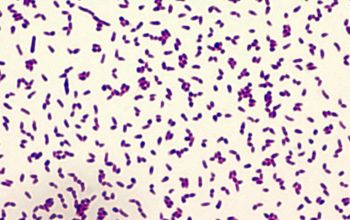 Rhodococcus equi / Prescottella equi Gram stain