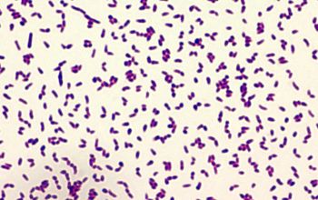 Rhodococcus equi  (Prescottella equi) Gram stain