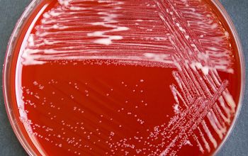 Rhodococcus equi  (Prescottella equi) Blood Agar 24h culture incubated with CO2