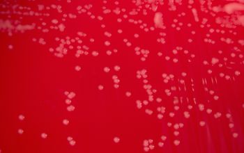 Rhodococcus equi  (Prescottella equi) Blood Agar 24h culture incubated with CO2