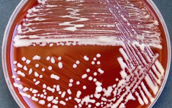 Rhodococcus equi / Prescottella equi Blood Agar 48h culture incubated with CO2