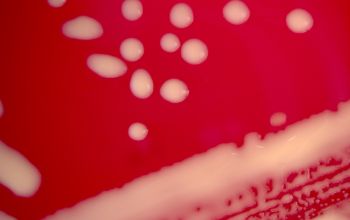 Rhodococcus equi  (Prescottella equi) Blood Agar 48h culture incubated with CO2