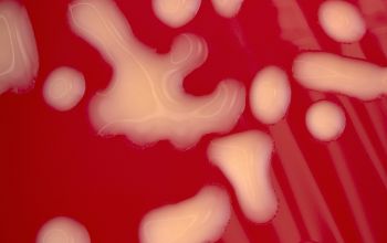 Rhodococcus equi  (Prescottella equi) Blood Agar 48h culture 