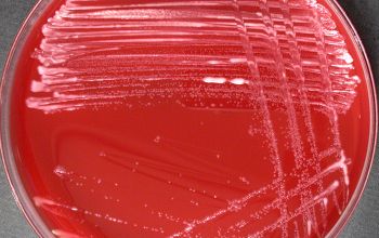 Rhodococcus equi  (Prescottella equi) Blood Agar 24h culture incubated with CO2