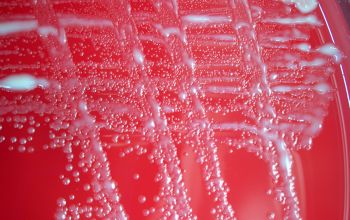 Rhodococcus equi  (Prescottella equi) Blood Agar 24h culture 