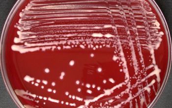 Rhodococcus equi  (Prescottella equi) Blood Agar 48h culture incubated with CO2