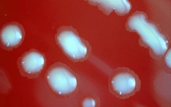 Rhodococcus equi / Prescottella equi Blood Agar 48h culture incubated with CO2