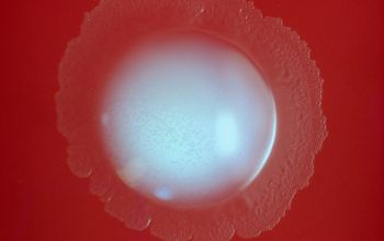 Rhodococcus equi  (Prescottella equi) Blood Agar 48h culture incubated with CO2