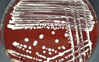 Rhodococcus equi  (Prescottella equi)  culture incubated with CO2