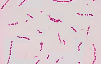 Roseomonas mucosa Gram stain