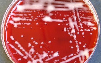 Roseomonas mucosa Blood Agar 48h culture incubated with CO2