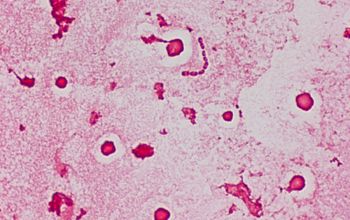 Roseomonas mucosa Gram stain