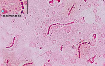 Roseomonas mucosa Gram stain