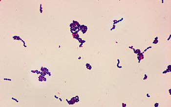 Rothia dentocariosa Gram stain