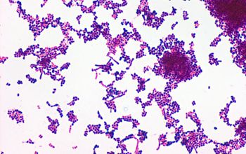 Rothia dentocariosa Gram stain