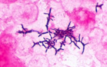 Rothia dentocariosa Gram stain