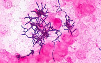 Rothia dentocariosa Gram stain