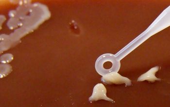 Rothia mucilaginosa  culture 