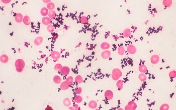 Rothia mucilaginosa Gram stain