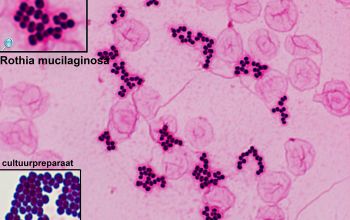 Rothia mucilaginosa Gram stain