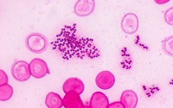 Rothia mucilaginosa Gram stain