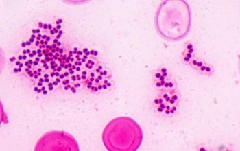 Rothia mucilaginosa Gram stain