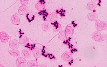 Rothia mucilaginosa Gram stain