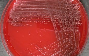 Rothia mucilaginosa Blood Agar 24h culture incubated with CO2
