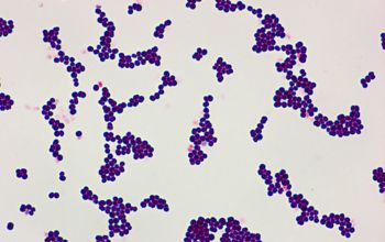 Rothia mucilaginosa Gram stain