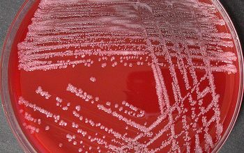 Rothia mucilaginosa Blood Agar 24h culture incubated with CO2